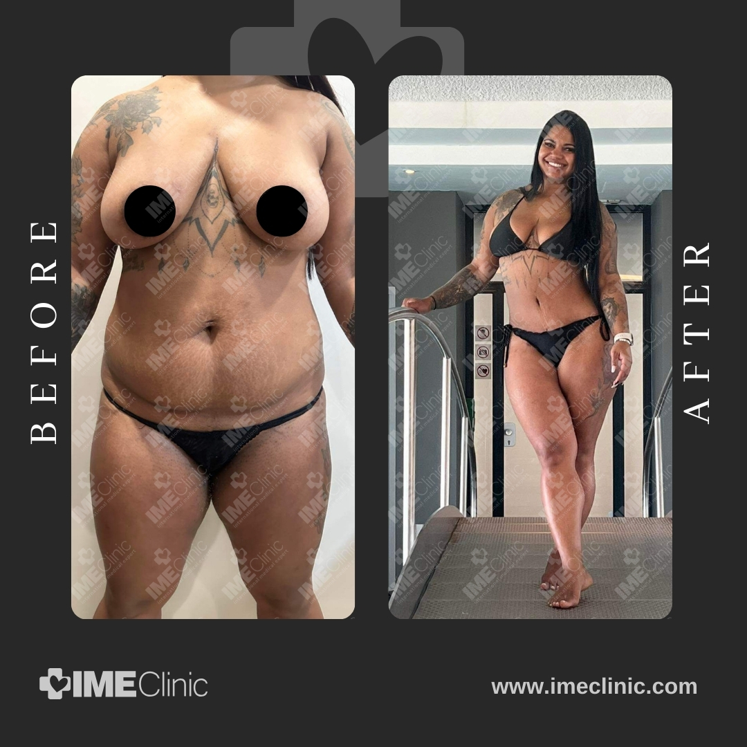 
                                     Before and after images of a woman showcasing her body transformation. The before image shows her facing forward, while the after image shows her smiling and standing in a different pose, both wearing black swimsuits.